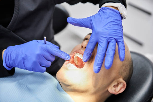 Best Emergency Wisdom Teeth Removal in Rush Springs, OK